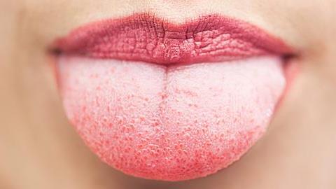 Τι μαρτυρά η γλώσσα για την κατάσταση της υγείας σας