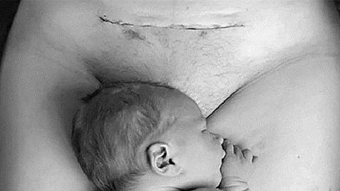 «Γιατί δεν ντρέπομαι που γέννησα με καισαρική!»