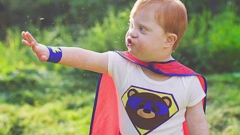 Μια σπάνια φωτογράφηση για σπάνια παιδιά