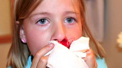 Γιατί ανοίγει συχνά η μύτη της κόρης μου;