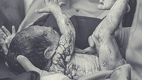 Οι συγκλονιστικότερες φωτογραφίες τοκετών που έχετε δει