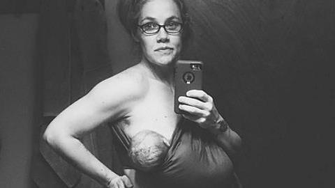 Έτσι είναι το σώμα μιας λεχώνας 24 ώρες μετά τη γέννα!