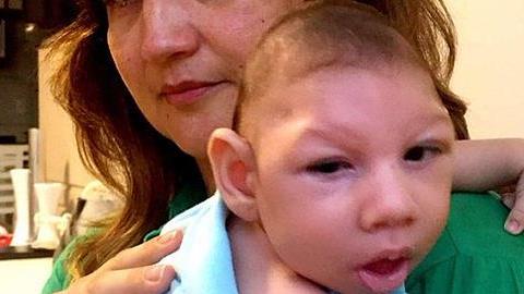 Τι είναι ο ιός Ζίκα που απειλεί την υγεία των μωρών