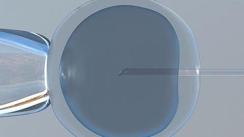 Εξωσωματική γονιμοποίηση