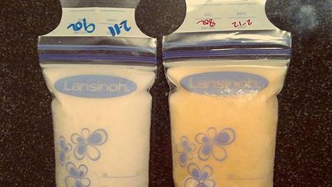 Αυτή η φωτογραφία αποδεικνύει ότι το μητρικό γάλα είναι θαυματουργό!