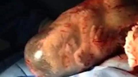 Η μαγεία της γέννησης: Μωρό βγαίνει από τον αμνιακό σάκο και παίρνει την πρώτη του ανάσα!