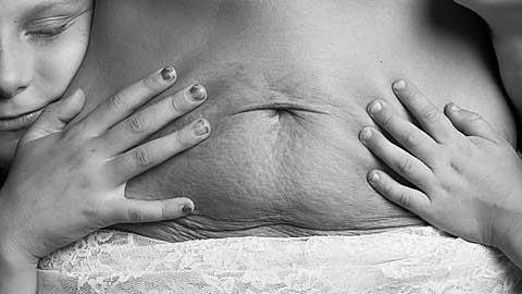 «Στη μαμά που γέννησε με καισαρική»