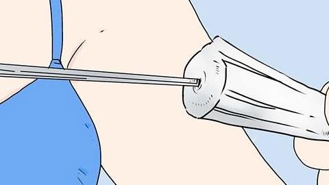 Τι είναι το Σύνδρομο Τοξικού Σοκ που προκαλείται από τα ταμπόν