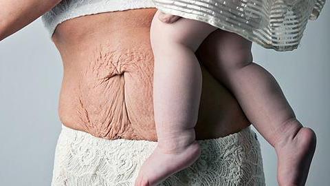 12 γυναίκες δείχνουν πώς πραγματικά είναι το σώμα τους μετά την εγκυμοσύνη