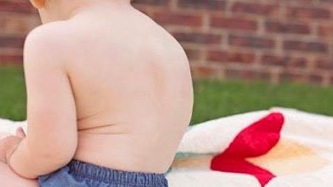 Γιατί καμπουριάζει;