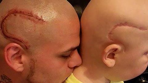 Πατέρας κάνει τατουάζ το σημάδι του γιου του για να του συμπαρασταθεί!