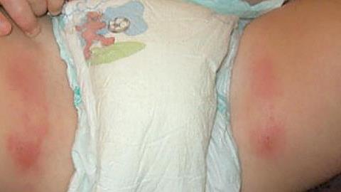 Άσχημο σύγκαμα