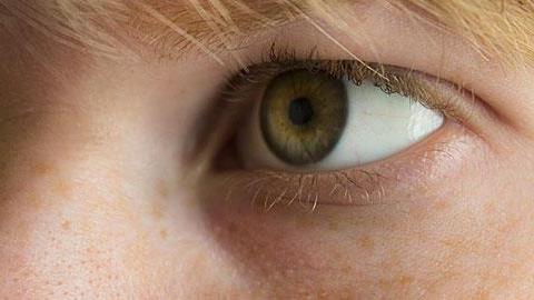 Αγόρι με μαύρους κύκλους κάτω από τα μάτια