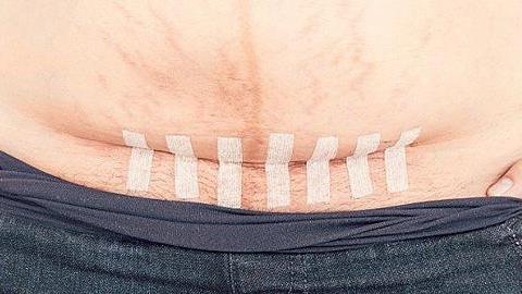 Μια μαμά απαντά σε αυτούς που πιστεύουν ότι η καισαρική είναι «ο εύκολος τρόπος»