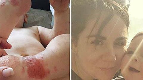 «Πώς ένα φιλί από έναν άγνωστο έβλαψε την υγεία του μωρού μου»