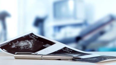 Ενδομητρίωση: Τα αίτια, τα συμπτώματα και η θεραπεία