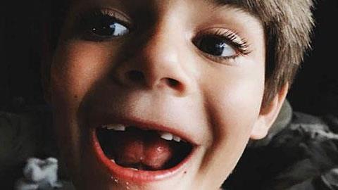 Όταν κουνιέται το δόντι του παιδιού μου: Μια... ανυπόφορη στιγμή!