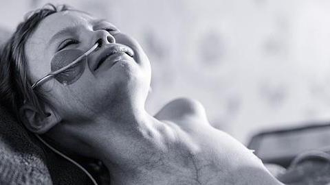 Το πραγματικό πρόσωπο του παιδικού καρκίνου σε μία μόνο φωτογραφία