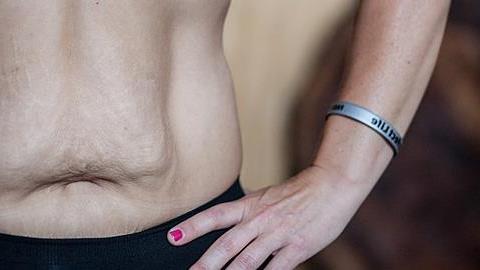 «Έμαθα να αγαπάω το σώμα μου για όλα όσα έχει κάνει»