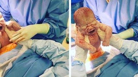 Μια ξεχωριστή καισαρική: Μαμά αποφασίζει να ξεγεννήσει η ίδια το μωρό της!