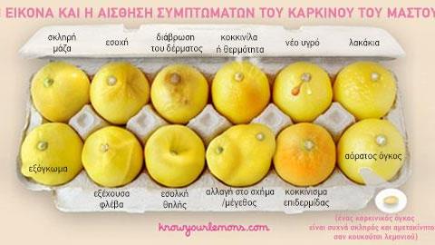 Η φωτογραφία που δείχνει με ακρίβεια τα συμπτώματα καρκίνου του μαστού