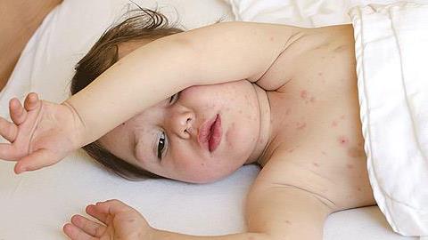 Πότε πρέπει να καλέσω τον παιδίατρο: Τα συμπτώματα που δεν πρέπει να αγνοήσετε