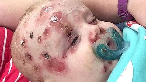 Έκκληση μιας μαμάς στους γονείς να εμβολιάζουν τα παιδιά τους μετά την περιπέτεια υγείας του μωρού της