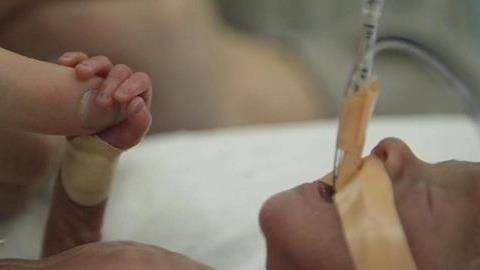 Το βίντεο με την ιστορία αυτού του πρόωρου μωρού και των γονιών του θα σας συγκινήσει