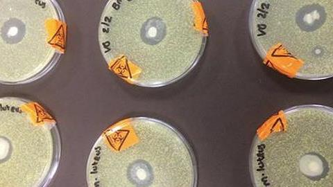 Ένα απλό πείραμα αποδεικνύει πώς το μητρικό γάλα καταπολεμά τους ιούς!