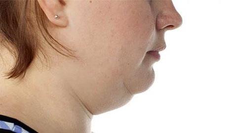 Πώς να χάσω το προγούλι