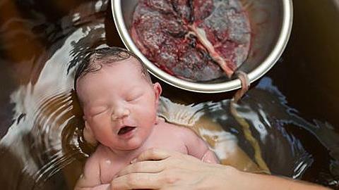 Πριν κοπεί ο ομφάλιος λώρος: 16 συγκλονιστικές φωτογραφίες