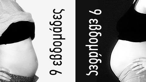 Οι διαφορές μονής-διπλής κύησης σε φωτογραφίες