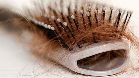 Αφού γέννησα, έχω τρομερή τριχόπτωση. Είναι φυσιολογικό;