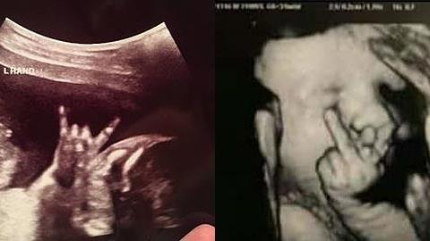 9 απίστευτοι υπέρηχοι μωρών που πρέπει να δείτε!