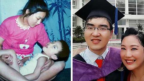 Αρνήθηκε να εγκαταλείψει το ανάπηρο μωρό της και σήμερα τον καμαρώνει στο Harvard