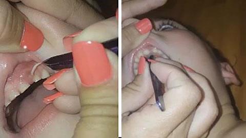 Γιατί τα παιδιά δεν πρέπει να τρώνε τα νύχια τους: Ένα βίντεο-σοκ