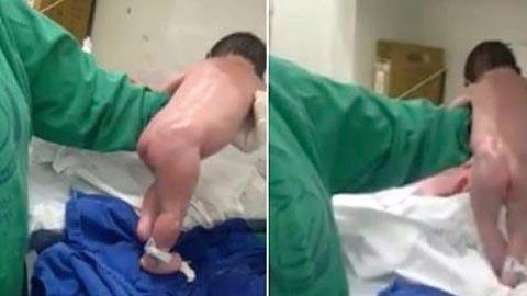 Απίστευτο βίντεο: Δείτε το μωρό που περπατά αμέσως μετά τη γέννησή του