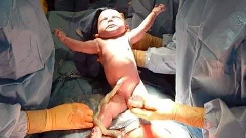 10 (ακραία) ρεαλιστικές φωτογραφίες τοκετού