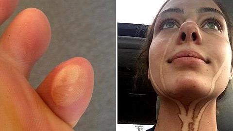 11 βάσανα που κάθε γυναίκα περνάει το καλοκαίρι