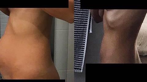 «Έτσι είμαι εγώ. Έτσι είναι η ενδομητρίωση»: Ο αγώνας μιας 27χρονης κοπέλας