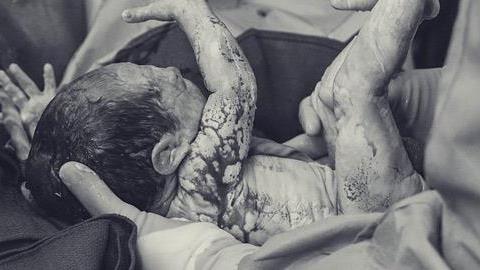 15 συγκλονιστικές φωτογραφίες από την αίθουσα τοκετού