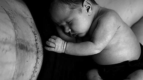 «Το σώμα μου δεν με απογοήτευσε»: οι «ωμές» φωτογραφίες μιας μαμάς μετά την καισαρική