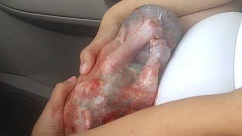 Μωρό γεννιέται στον αμνιακό του σάκο μέσα στο αυτοκίνητο!