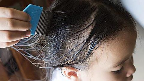 Πώς να καταπολεμήσω οριστικά τις ψείρες στα παιδιά; Έχω δοκιμάσει τα πάντα!