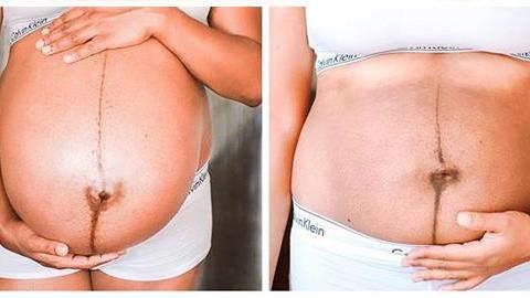 «Έτσι ήταν το σώμα μου πριν και μετά τον τοκετό»