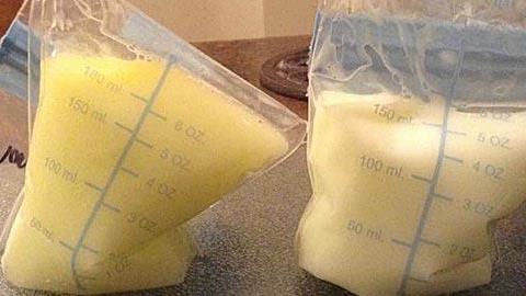 Η φωτογραφία που αποδεικνύει ότι το μητρικό γάλα είναι θαυματουργό