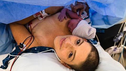 Γυναίκα φέρνει στον κόσμο το παιδί της ενώ δίνει μάχη με τον καρκίνο του μαστού