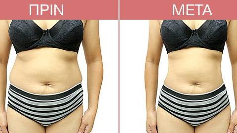 Πώς να χάσετε βάρος χωρίς δίαιτα