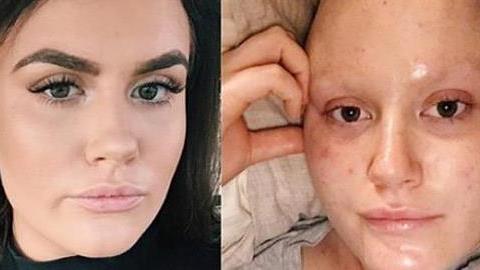 Πολεμώντας τον καρκίνο του μαστού στα 21: Το μήνυμα μιας πολύ δυνατής κοπέλας