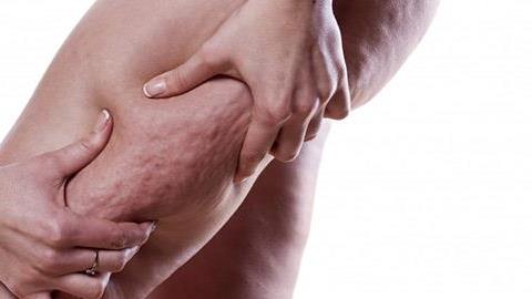 Πώς θα φύγει η κυτταρίτιδα;